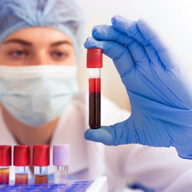 Blood Tests